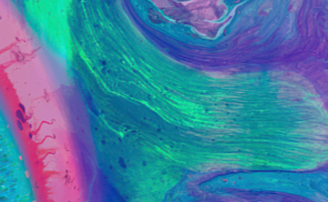 Clinical Evidence Summary Irritable Bowel Syndrome And A Dual Strain Probiotic
